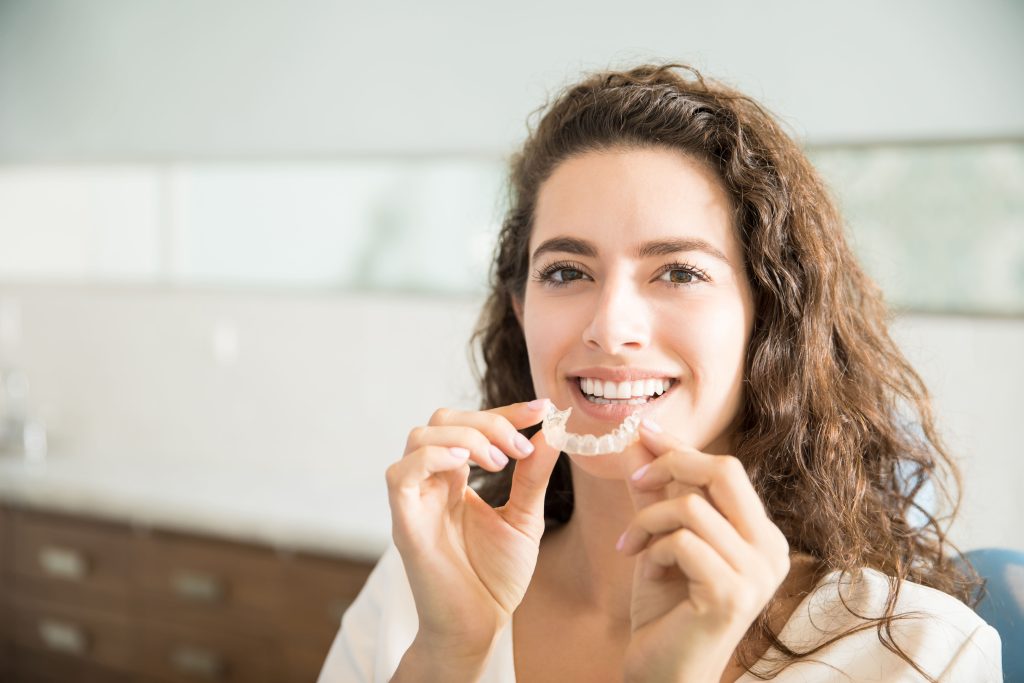 Switch from braces to aligners - TIPS